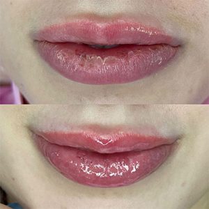 hydra-gloss-drelore-beauty Hydra Gloss - DreLore Beauty